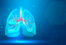 Estudo começa a desvendar desenvolvimento da fibrose pulmonar idiopática